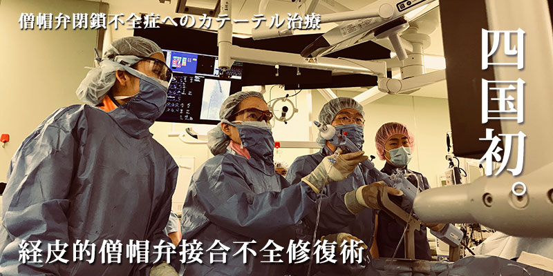 経皮的僧帽弁接合不全修復術