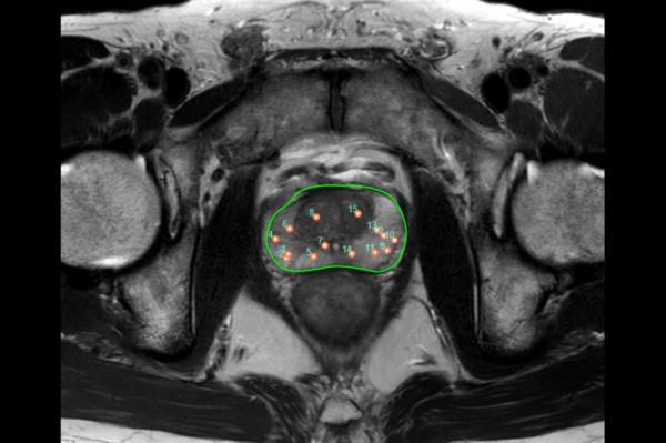 前立腺MRIにはどれくらい時間がかかりますか?